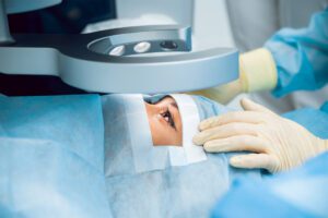 Read more about the article Myopia Laser – Refractive Surgery